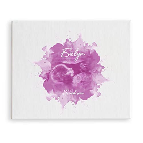 [SF Customizables] Sonogram Echography Foetus Gender Ultrasound Watercolor Wall Art Print [Canvas Pr