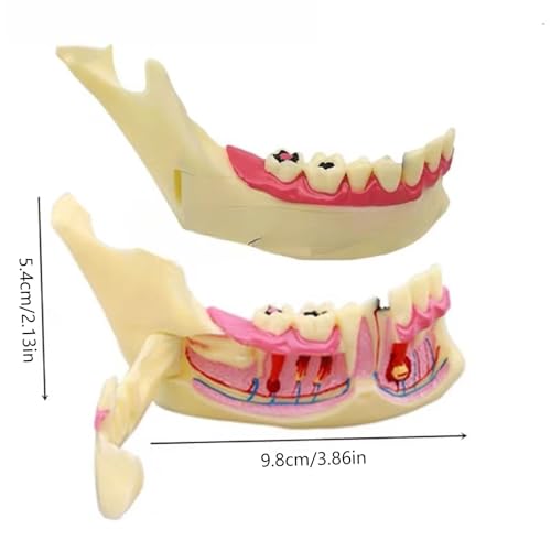 Modelo de anatomía de mandíbula desmontable y móvil para demostración médica 3