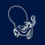 Sigur Rós - Ágætis Byrjun (2 LP) [Vinilo]