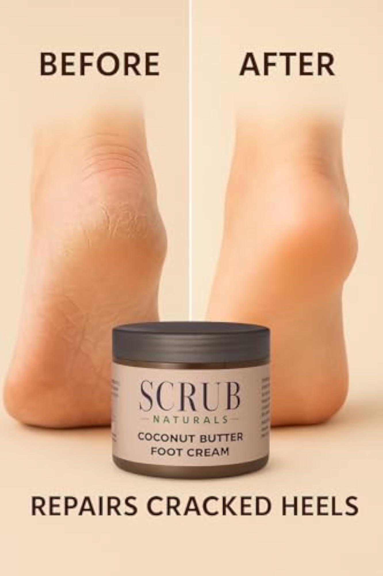 Organic Coconut Butter Foot Cream for Cracked Heels