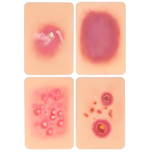 Image of Bacterial Infected Wound Model for Medical Education | Wound Packing Trainer, Palm Sized Wound Simulation Models, Wound Care Demonstrations Tool, 4PCS