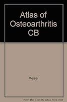 Atlas of Osteoarthritis 0812109325 Book Cover
