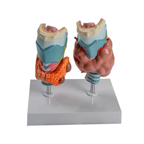 Modèle de thyroïde pathologique pour simulation de démonstration clinique