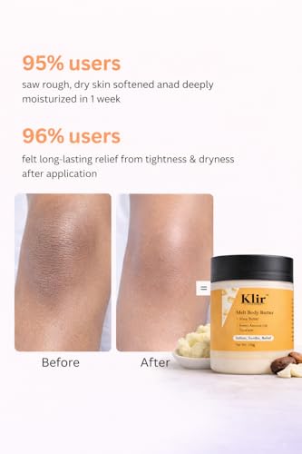 Image of KLIR Melt Body Butter | Deep Nourishing Moisturizer With Shea Butter, Cocoa Butter, Sweet Almond Oil (2 * 100gm)