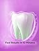 Bright White Smiles 44% Whitening Gel – 20 Syringes(3ml) – Fast-Acting Carbamide Peroxide Teeth Whitener