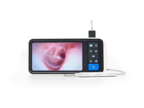 Lifenaxx Otoskop mit Display, Kamera für Bild-, Videoaufnahmen für Menschen, Hunde, Katzen etc - Set zur Ohrenreinigung mit 4 Ohrlöffeln, entfernt Ohrenschmalz, Verunreinigungen - Ohr Kamera LX-033 Cover