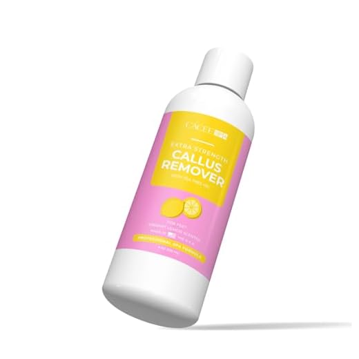 Cacee Callus Remover for Feet 8oz, Gel Formula with Tea Tree Oil & Lemon Scent, Works Great with Foot Scrubber, Foot File, or Pumice Stone, Callous or Corn Remover