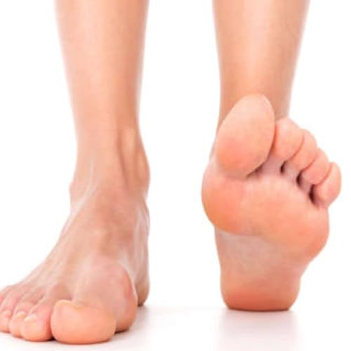 Plantar Fasciitis