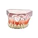 Dentalmall Dental Upper JAW Implants Model Overdenture with 4 Superior Teeth Demo Transparent Vision for Education and Study Model Tool M6001 Pink