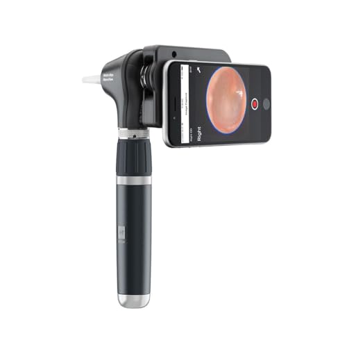 KASHSURG 3.5V LED Macroview Plus Otoscope with Lithium Ion Rechargeable Handle, Iexaminer Smart, Soft Case