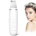 ANLAN Peeling Ultrasónico Facial Skin Scrubber Exfoliación Limpiador de Poros para Limpieza y Cuidado (Blanco)