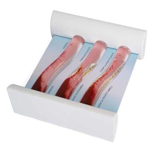 Modèle anatomique de vaisseaux LDL pour expliquer le cholestérol en consultation - 3