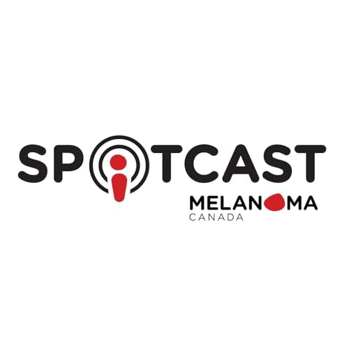 『Spotcast』のカバーアート