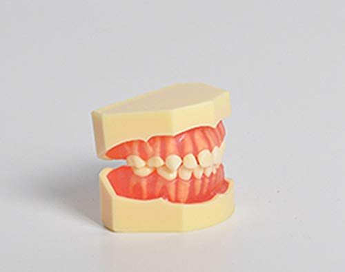 Dental Study Model Children Kids Primary Removable Teeth Pit Fissure Sealant Communication (Removable teeth)