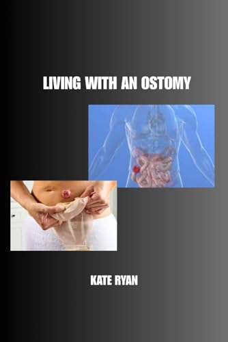LIVING WITH AN OSTOMY: A Practical Guide to Thriving After Surgery