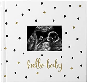 Pearhead Baby Photo Album, Baby Book Keepsake for New and Expecting Parents, Gender-Neutral Baby Accessory, Black and Gold Polka Dot