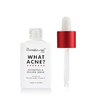 The Crème Shop Korean Skin Care | What Acne? - Hydrating & Healing Vitamin C Serum for Acne Treatment, Dull Skin, irritation, Restoring, Calming, Pore Tightening — image 2