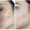 HigherDOSE Glow Serum - Facial Serum Formulated to Plump, Hydrate, and Stimulate Radiant Skin - Help Reduce Fine Lines and Wrinkles - 1 oz
