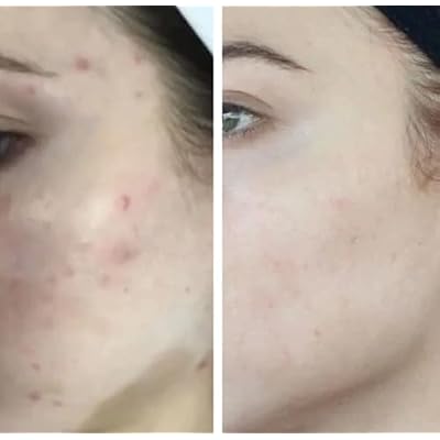 HigherDOSE Glow Serum - Facial Serum Formulated to Plump, Hydrate, and Stimulate Radiant Skin - Help Reduce Fine Lines and Wrinkles - 1 oz
