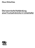  Die keramische Verblendung einer Frontzahnbrücke im Unterkiefer