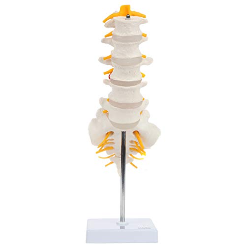 Section lombaire avec sacrum Axis Scientific pour comprendre la sciatique