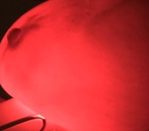 Équipement médical de diagnostic mammaire Luminous à LED rouge - 4