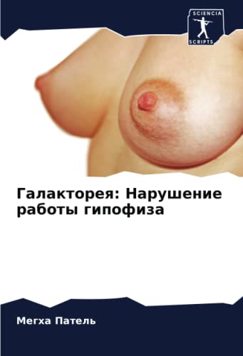 Галакторея: Нарушение работы гипофиза (Russian Edition)