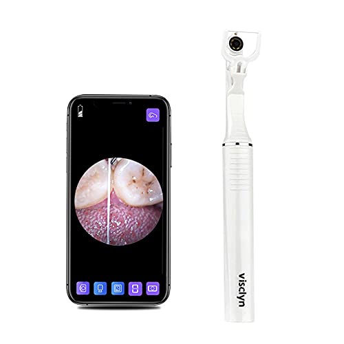 Visclyn Smart Dental Floss - Visual Toothpick with Camera and Intelligent App | Including 1 Smart Floss Holder, 30 Disposable Floss Picks and 20 Cleaning Pads