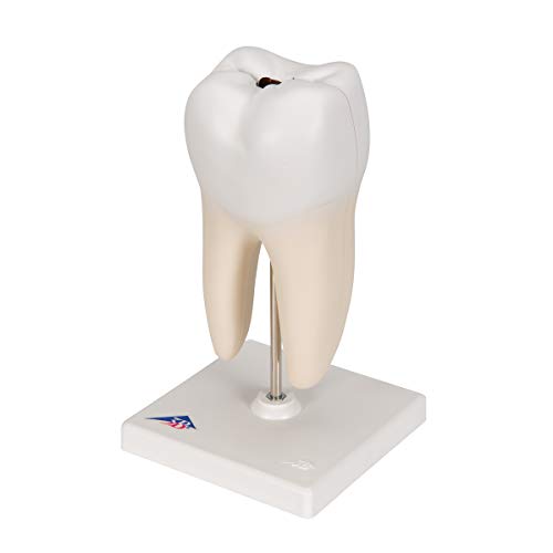 Image of 3B Scientific D10 /4 Lower Twin-Root Molar Showing Cavaties 2-part - 3B Smart Anatomy