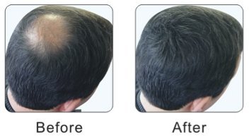 3 x Allure Hair Building Fibers (HBF) (22g) (Black)