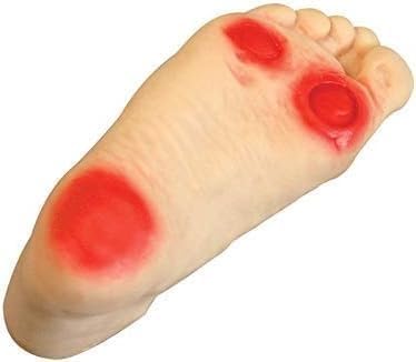 Simulateur du pied diabétique pour l'éducation des patients en cabinet médical