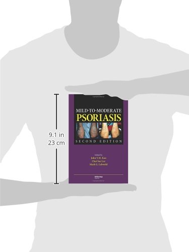 Mild-to-Moderate Psoriasis, Second Edition