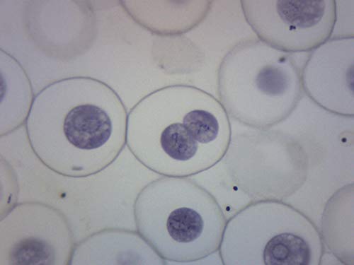 Image of EISCO Ascaris & Onion Mitosis, Prepared Microscope Slide - 75 x 25mm - Plant & Animal Mitosis, Introductory Microscopy