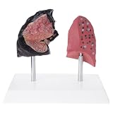 1 x Raucher gegen Lunge Anatomisches Modell, PVC, klinisches Lehrwerkzeug für Fitnessausbildung, medizinische Lehrgeräte
