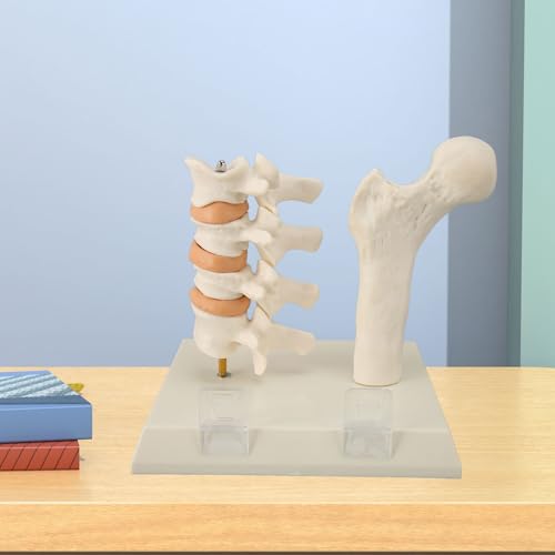 Image of ZJchao Osteoporosis Spine Model, ABS Anatomical Osteoporosis Model, Pathological Changes Visualization Versatile Learning Tool for Anatomy Education Constructed