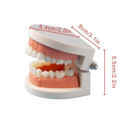 RuiJOTWAT Kariesforschungsmodell, 1:1-Modell künstlicher Zähne für Erwachsene für die Mundhygiene, Unterrichten von Kindern zur Zahnanatomie, Aufklärung zur Mundpflege