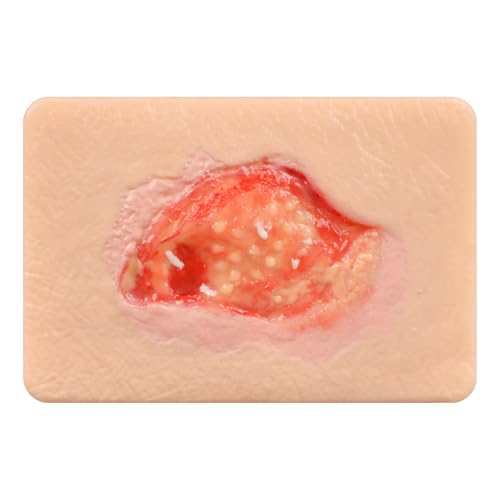 Image of Unhealthy Granulation Wound Simulation Models for Medical Education