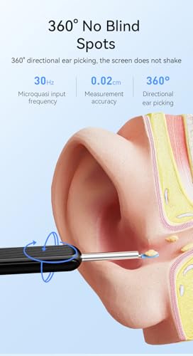Image of Wireless Ear Wax Removal Tool with Camera, Smart Visual Ear Cleaner, 5MP HD Endoscope, Safe Silicone Tip, Type-C Charging
