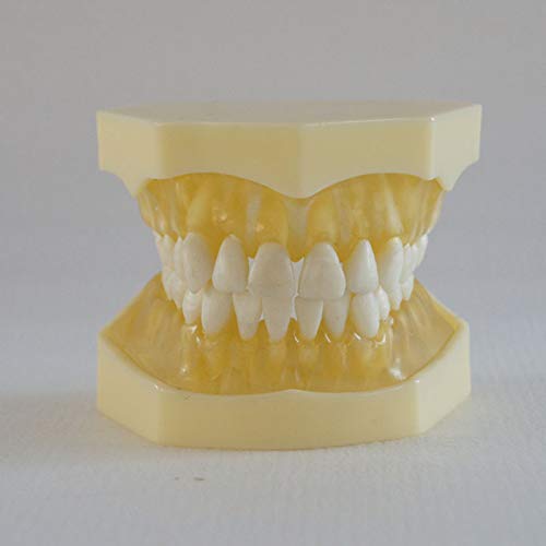 28 Teeth Removable Standard Dental Model (Removable Standard Dental Model (28pcs Teeth,Soft Gum))