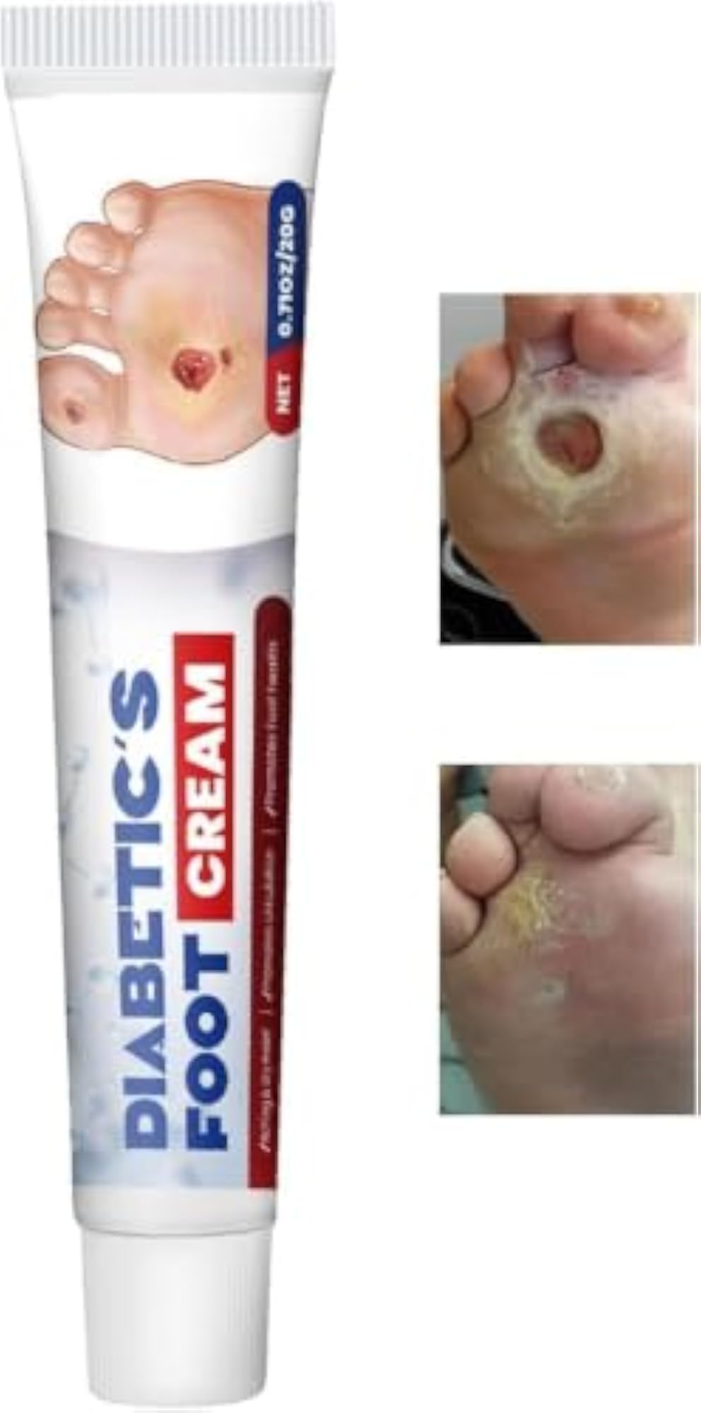 Diabetic Foot Care Cream 20g, Deep Moisturizing Formula