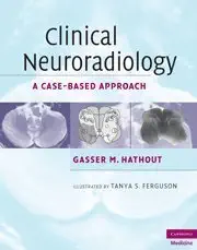 Clinical Neuroradiology: A Case-Based Approach (Cambridge Medicine (Hardcover)) by Gasser M. Hathout Clinical Neuroradiology: A Case-Based Approach (Cambridge Medicine (Hardcover)) by Gasser M. Hathout book cover
