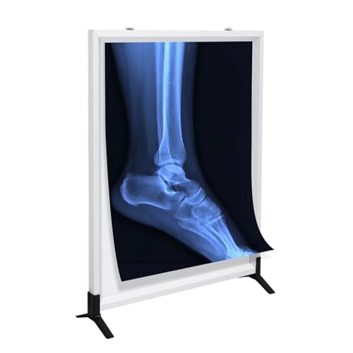 LED X-Ray Film Viewer Light Box, Medical X-Ray Film Illuminator Light Box, Acrylic Panel, Uniform Lighting, Knob Adjustment Control for Clinics & Hospitals(49.5x40.5x2cm/19.5x16x0.8in)