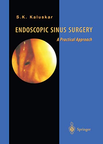 Endoscopic Sinus Surgery: A Practical Approach view 2
