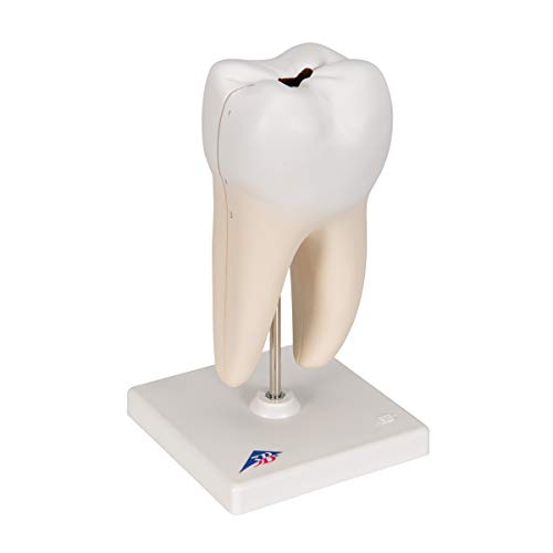 Image of 3B Scientific D10 /4 Lower Twin-Root Molar Showing Cavaties 2-part - 3B Smart Anatomy