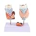 menolana PVC Human Thyroid Normal & Pathological Anatomy Model for Display Teaching