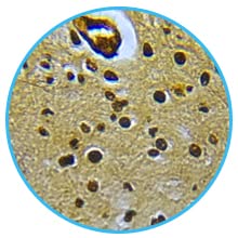 25 vetrini preparati per microscopio - categoria: Istologia