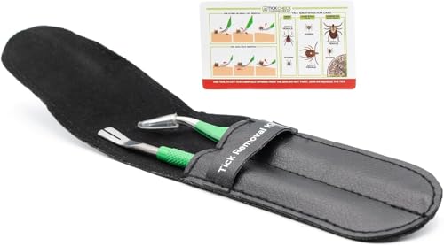 TickCheck Premium Tick Remover Kit