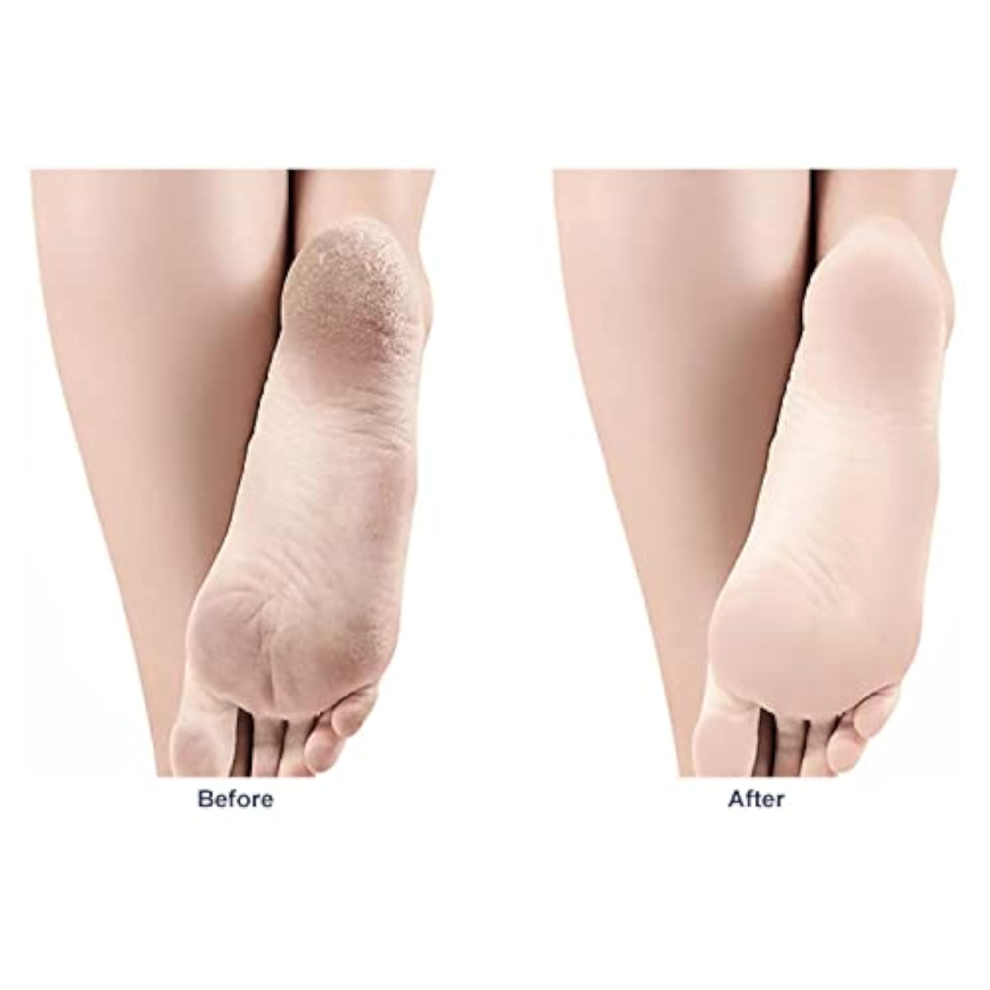 Foot File Nano Glass Exfoliating Scrubber for Smooth Feet