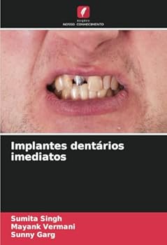 Paperback Implantes dentários imediatos [Portuguese] Book