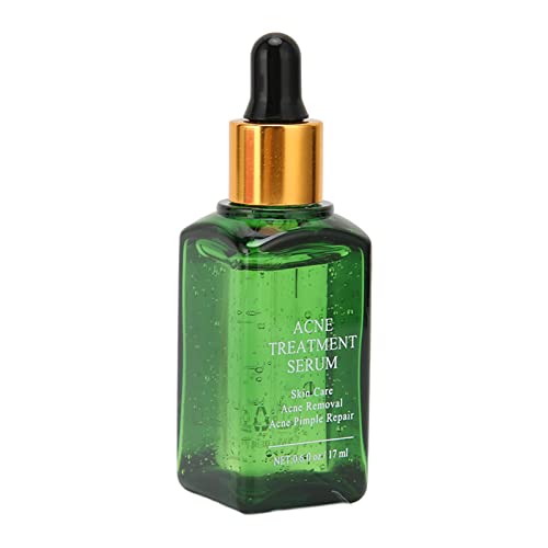 Reparación suave refrescante del tratamiento del acné del extracto de la planta del suero del retiro del acné para el viaje